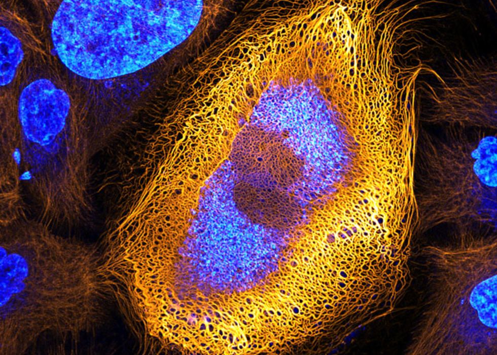 HaCaT cells